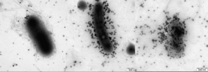 Efeito antibacteriano das nanopartículas de prata