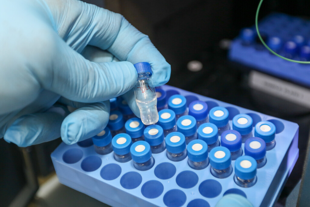 Foto colorida mostra a mão de uma pessoa, vestindo luva azul, segurando um frasco de vidro com tampa azul sobre uma base de plástico do tipo colmeia onde estão outras cerca de trinta amostras de plasma sanguíneo. Fim da descrição.